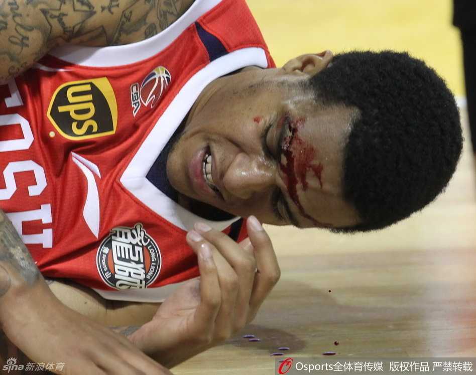 哈达迪张开长臂摘下篮板，随后一传策动快攻