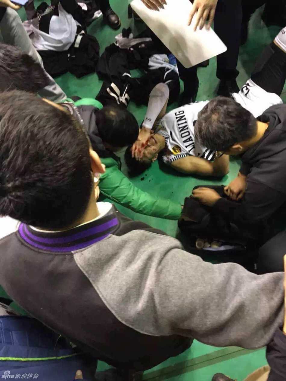 赛场惊魂:郭艾伦遭水瓶袭击血洒本溪,文明底线何在 郭艾伦在队友的搀扶下缓缓走向球员通道,他低垂着头,只能看到后脑勺缠着的白色绷带,背影显得无助而落寞。