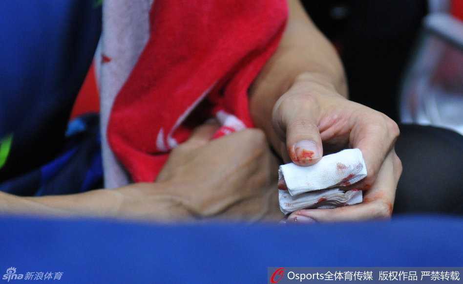 十指連心傷與恨:易建聯血灑總決賽之夜 鮮血從指間滲出,易建聯低頭凝視著傷口,眼神裡充滿了對戰局的不甘與無奈。