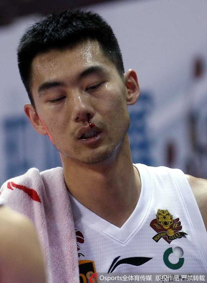 队医紧急进场进行处理，崔晋铭仰着头试图止血，身旁的队友们面露关切，目光紧紧锁定在他身上。