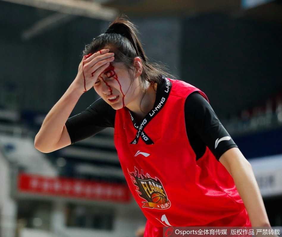 受伤后的郭子瑄在队医和队友的搀扶下缓缓走向场边，她用手捂着头部的伤口，但神情依然坚毅，不甘就这样离开赛场。