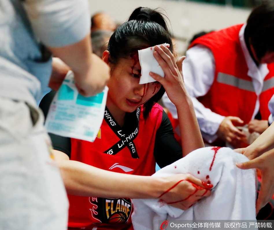 终场哨响，队友们在场上激烈角逐，而场边的郭子瑄头部缠着厚厚的染血绷带，眼神复杂地注视着这一切，这一刻她的坚韧与无奈令人动容。